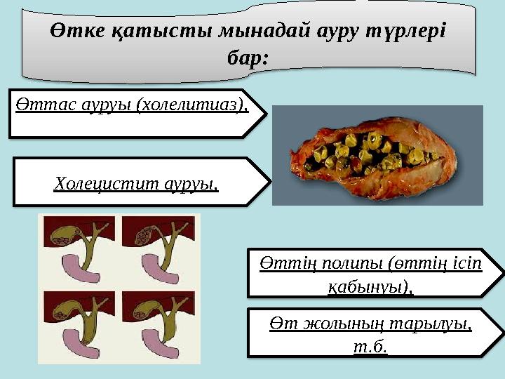 Өтке қатысты мынадай ауру түрлері бар: Өттас ауруы (холелитиаз), Өт жолының тарылуы, т.б. Холецистит ауруы, Өттің полипы