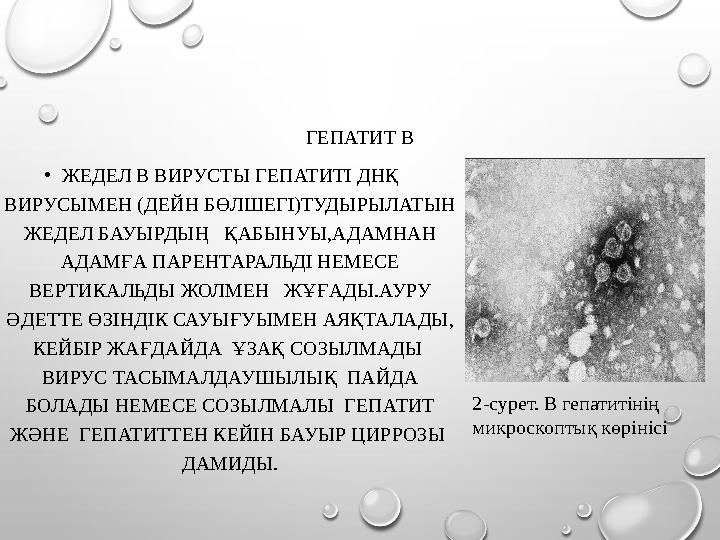 ГЕПАТИТ В •ЖЕДЕЛ В ВИРУСТЫ ГЕПАТИТІ ДНҚ ВИРУСЫМЕН (ДЕЙН БӨЛШЕГІ)ТУДЫРЫЛАТЫН ЖЕДЕЛ БАУЫРДЫҢ ҚАБЫНУЫ,АДАМНАН АДАМҒА ПАРЕНТАРА