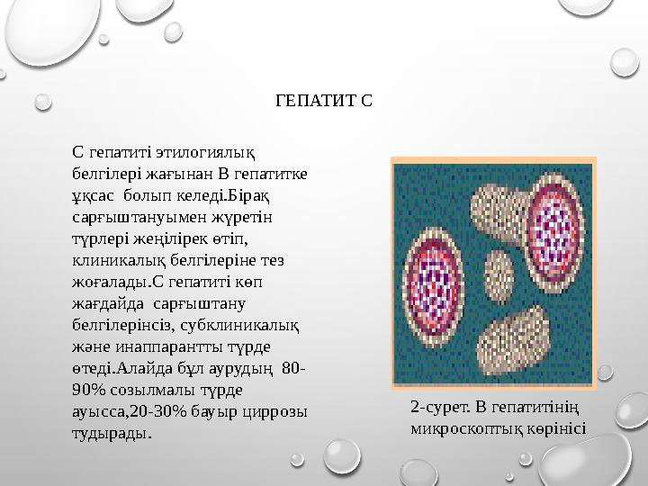 ГЕПАТИТ С С гепатиті этилогиялық белгілері жағынан В гепатитке ұқсас болып келеді.Бірақ сарғыштануымен жүретін түрлері жеңі