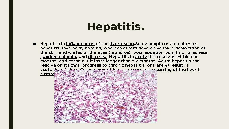 Hepatitis. ■Hepatitis is inflammation of the liver tissue.Some people or animals with hepatitis have no symptoms, whereas other