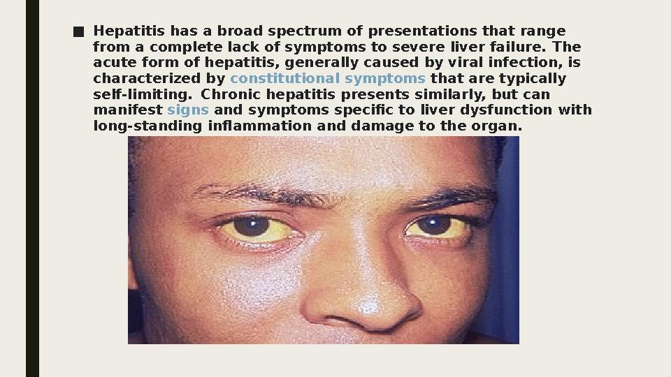 ■Hepatitis has a broad spectrum of presentations that range from a complete lack of symptoms to severe liver failure. The