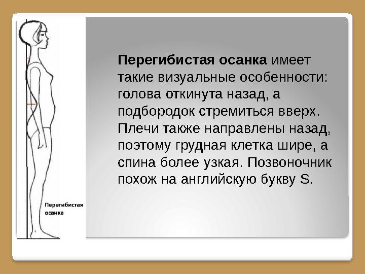 Перегибистая осанка имеет такие визуальные особенности: голова откинута назад, а подбородок стремиться вверх. Плечи также н
