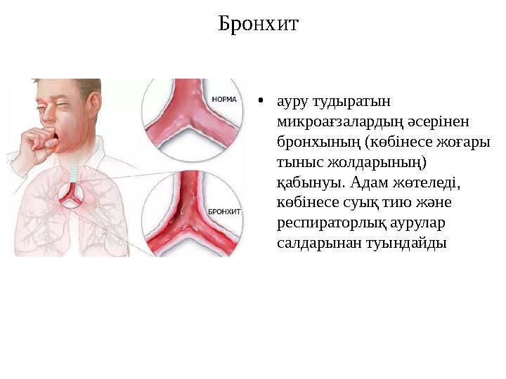 Бронхит •ауру тудыратын микроағзалардың әсерінен бронхының (көбінесе жоғары тыныс жолдарының) қабынуы. Адам жөтеледі, көбі