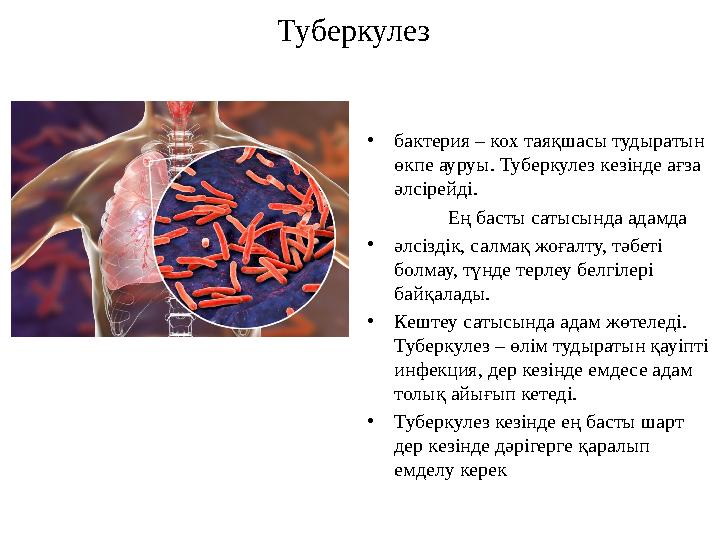 Туберкулез •бактерия – кох таяқшасы тудыратын өкпе ауруы. Туберкулез кезінде ағза әлсірейді. Ең басты сатыс