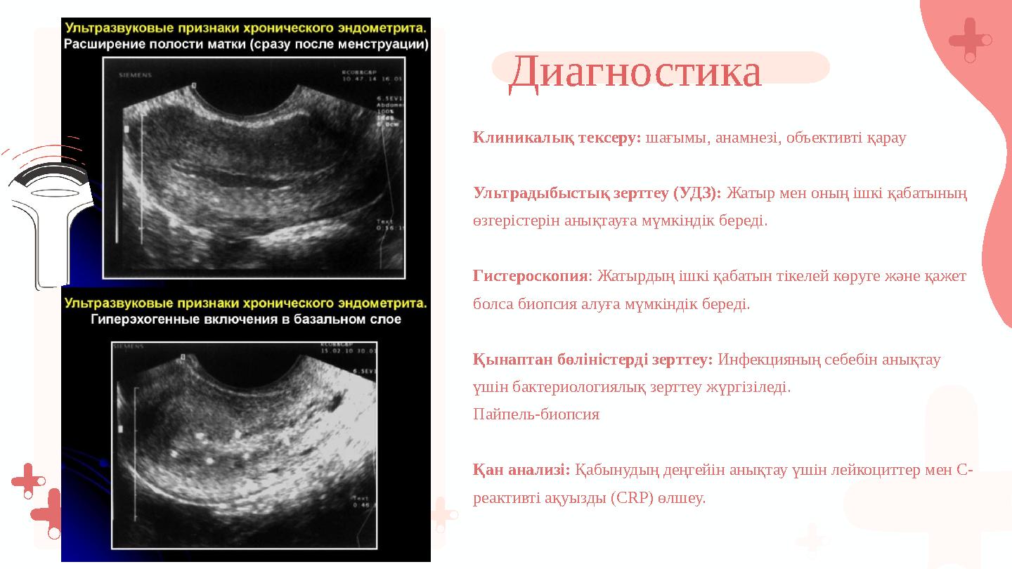 Клиникалық тексеру: шағымы, анамнезі, объективті қарау Ультрадыбыстық зерттеу (УДЗ): Жатыр мен оның ішкі қабатының өзгерістерін