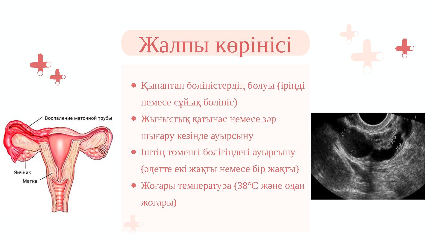 ●Қынаптан бөліністердің болуы (іріңді немесе сұйық бөлініс) ●Жыныстық қатынас немесе зәр шығару кезінде ауырсыну ●Іштің төменг