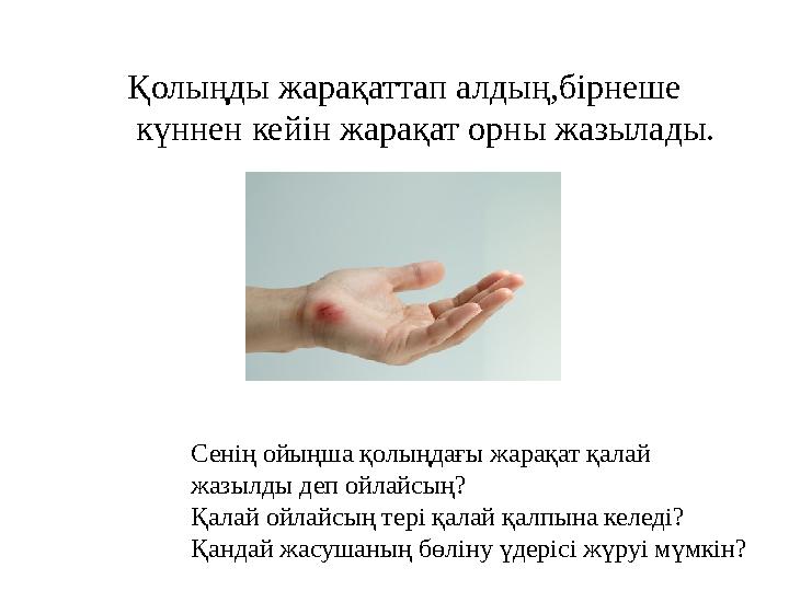 Қолыңды жарақаттап алдың,бірнеше күннен кейін жарақат орны жазылады. Сенің ойыңша қолыңдағы жарақат қалай жазылды деп ойлайсың Қолыңды жарақаттап алдың,бірнеше күннен кейін жарақат орны жазылады. Сенің ойыңша қолыңдағы жарақат қалай жазылды деп ойлайсың