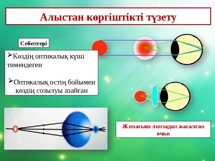 Жинағыш линзадан жасалған очки Алыстан көргіштікті түзету Себептері Көздің оптикалық күші төмендеген Оптикалық остің бойым