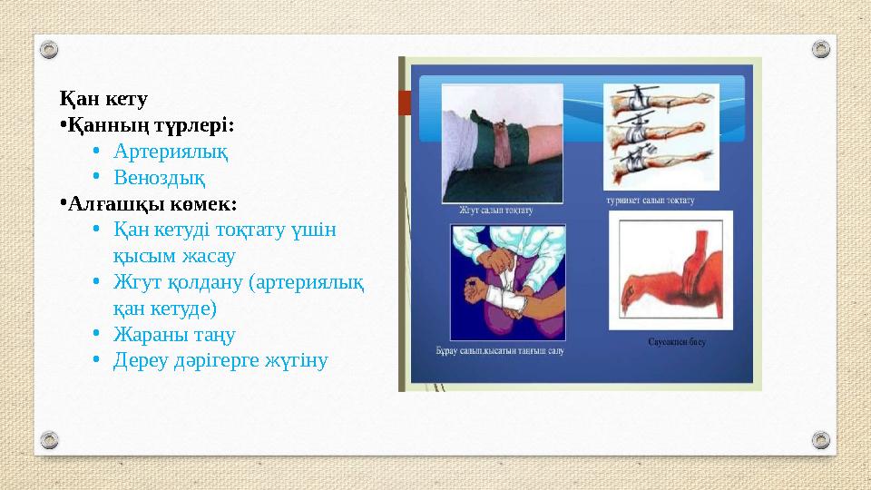 Қан кету •Қанның түрлері: •Артериялық •Веноздық •Алғашқы көмек: •Қан кетуді тоқтату үшін қысым жасау •Жгут қолдану (артериялық