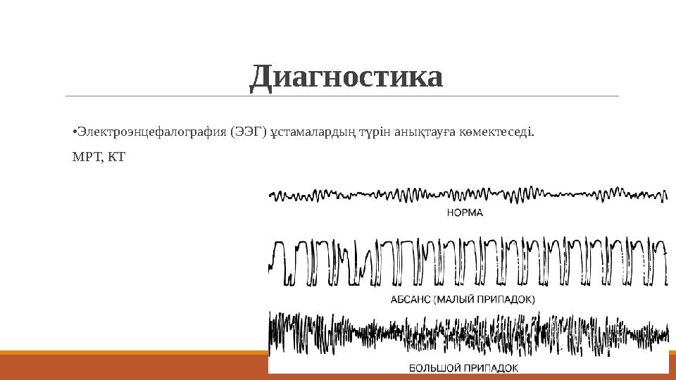 Диагностика •Электроэнцефалография (ЭЭГ) ұстамалардың түрін анықтауға көмектеседі. МРТ, КТ