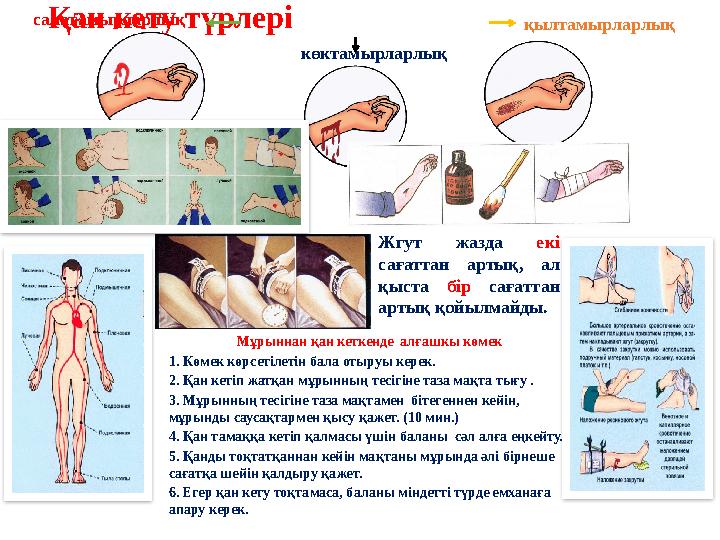 Қан кету түрлері Мұрыннан қан кеткенде алғашкы көмек 1. Көмек көрсетілетін бала отыруы керек. 2. Қан кетіп жатқан мұрынның