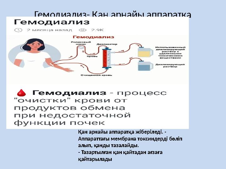 Гемодиализ- Қан арнайы аппаратқа жіберіледі. . Қан арнайы аппаратқа жіберіледі. - Аппараттағы мембрана токсиндерді бөліп алы
