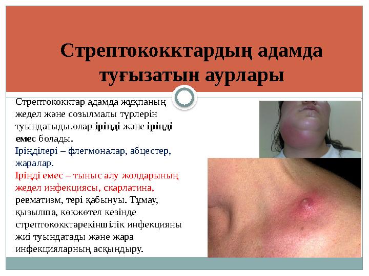 Стрептококктар адамда жұқпаның жедел және созылмалы түрлерін туындатыды.олар іріңді және іріңді емес болады. Іріңділері – ф