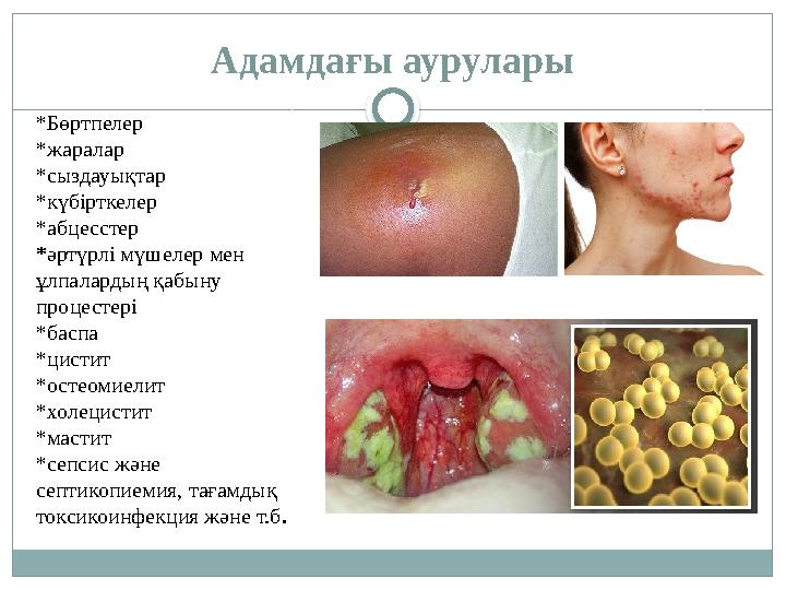Адамдағы аурулары *Бөртпелер *жаралар *сыздауықтар *күбірткелер *абцесстер *әртүрлі мүшелер мен ұлпалардың қабыну процестері