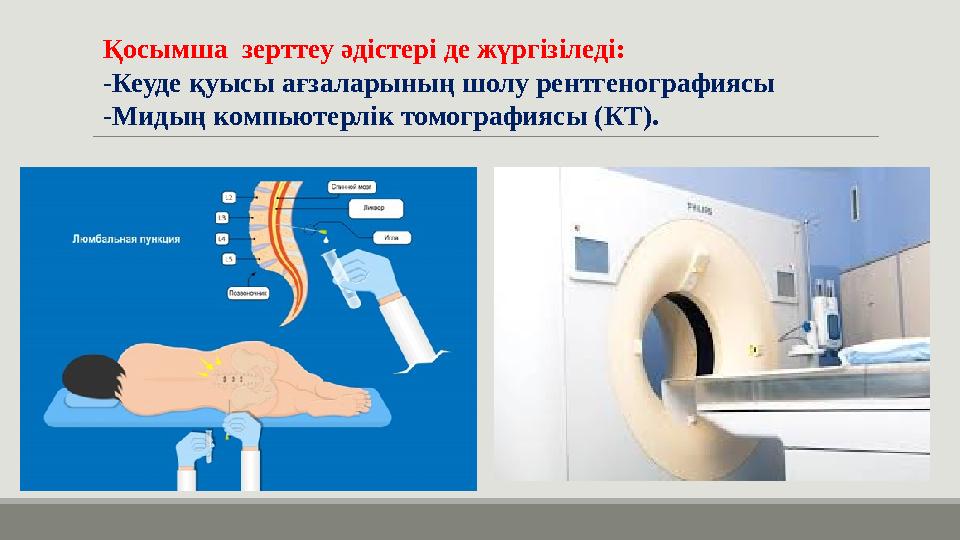 Қосымша зерттеу әдістері де жүргізіледі: -Кеуде қуысы ағзаларының шолу рентгенографиясы -Мидың компьютерлік томографиясы (КТ)