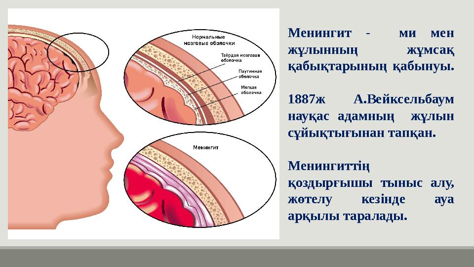 Менингит - ми мен жұлынның жұмсақ қабықтарының қабынуы. 1887ж А.Вейксельбаум науқас адамның жұлын сұйықтығынан тапқан. Мен