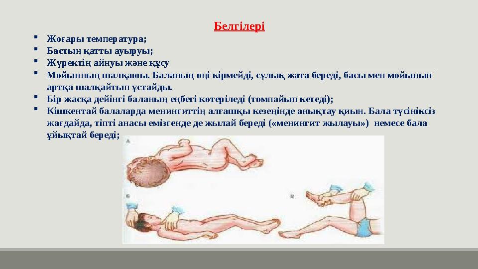 Белгілері Жоғары температура; Бастың қатты ауыруы; Жүректің айнуы және құсу Мойынның шалқаюы. Баланың өңі кірмейді, сұлық жа
