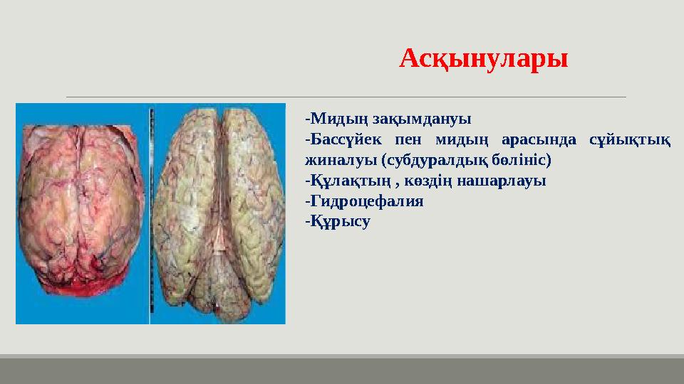 Асқынулары -Мидың зақымдануы -Бассүйек пен мидың арасында сұйықтық жиналуы (субдуралдық бөлініс) -Құлақтың , көздің нашарлауы