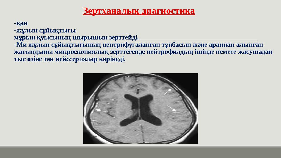 -қан -жұлын сұйықтығы мұрын қуысының шырышын зерттейді. -Ми жұлын сұйықтығының центрифугаланған тұнбасын және араннан алынған
