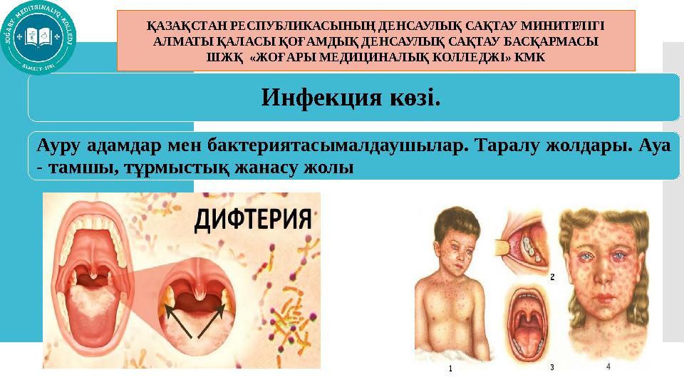 Инфекция көзі. Ауру адамдар мен бактериятасымалдаушылар. Таралу жолдары. Ауа - тамшы, тұрмыстық жанасу жолы ҚАЗАҚСТАН РЕСПУБ