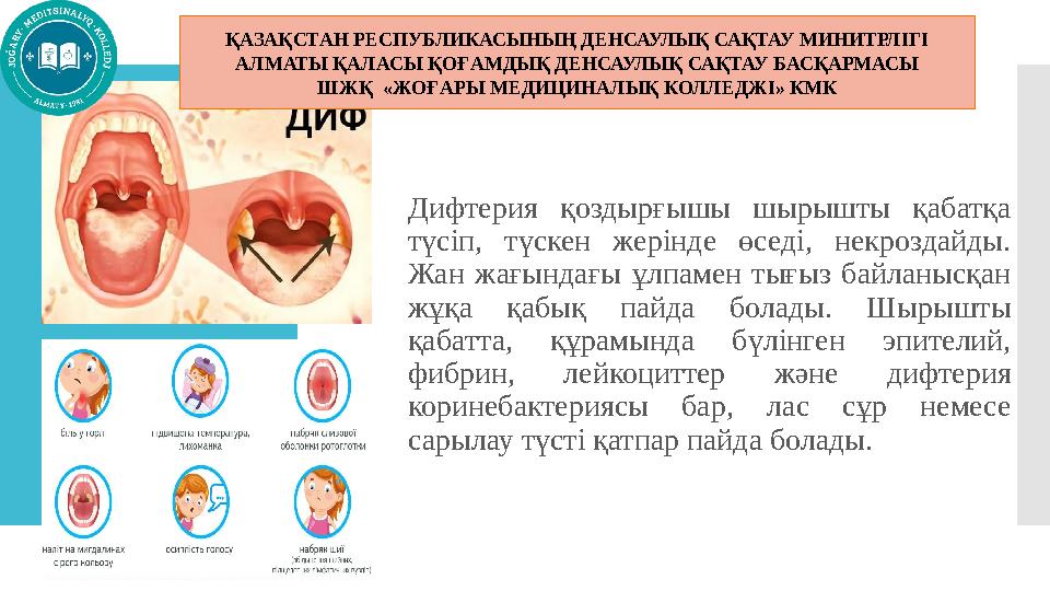 Дифтерия қоздырғышы шырышты қабатқа түсіп, түскен жерінде өседі, некроздайды. Жан жағындағы ұлпамен тығыз байланысқан жұқа қ