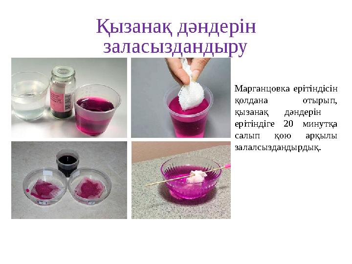 Қызанақ дәндерін заласыздандыру Марганцовка ерітіндісін қолдана отырып, қызанақ дәндерін ерітіндіге 20 минутқа салып қою а