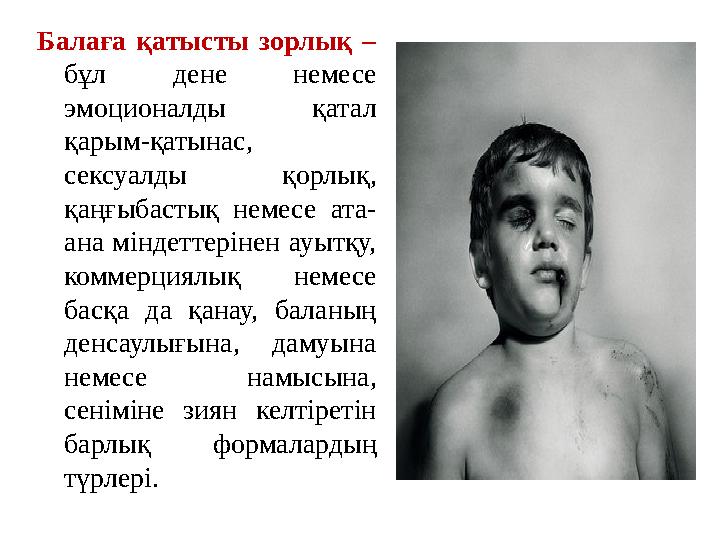 Әнші Алешаның интимдік жарқылдары