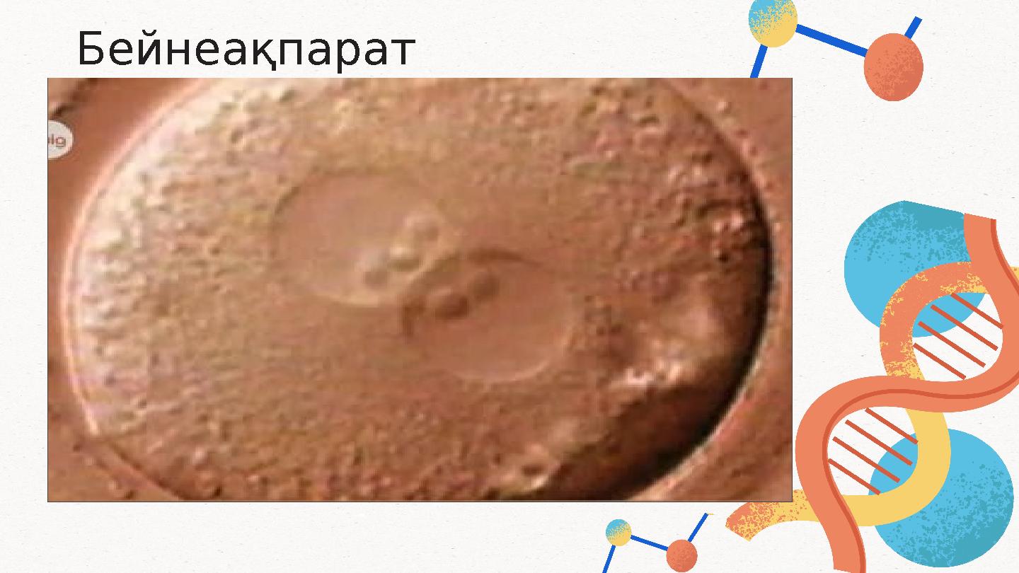 Бейнеақпарат