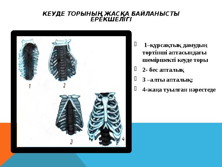 КЕУДЕ ТОРЫНЫҢ ЖАСҚА БАЙЛАНЫСТЫ ЕРЕКШЕЛІГІ  1–құрсақтық дамудың төртінші аптасындағы шеміршекті кеуде торы 2- бес апталық 