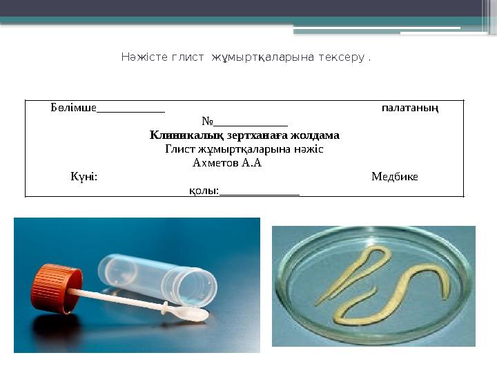 Нәжісте глист жұмыртқаларына тексеру . Бөлімше___________