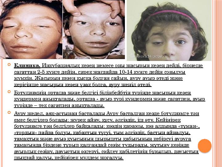 Клиника. Инкубациялық кезең немесе оны жасырын кезең дейді, бірнеше сағаттан 2-5 күнге дейін, сирек жағдайда 10-14 күнге д