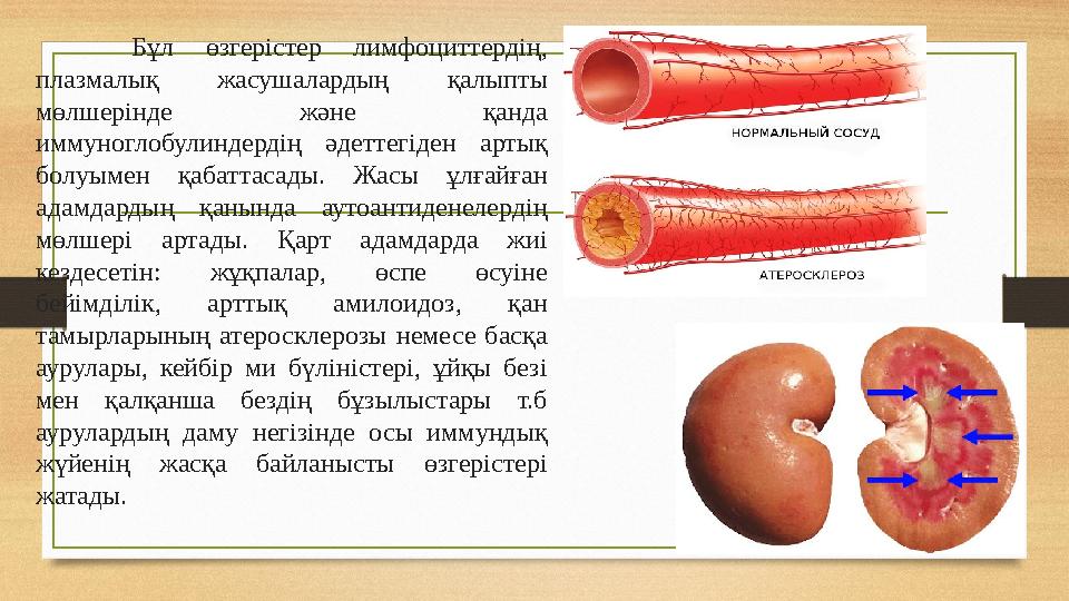 Бұл өзгерістер лимфоциттердің, плазмалық жасушалардың қалыпты мөлшерінде және қанда иммуноглобулиндердің әдеттегіден артық