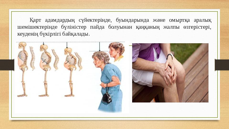 Қарт адамдардың сүйектерінде, буындарында және омыртқа аралық шемішектерінде бүліністер пайда болуынан қаңқаның жалпы өзгеріст