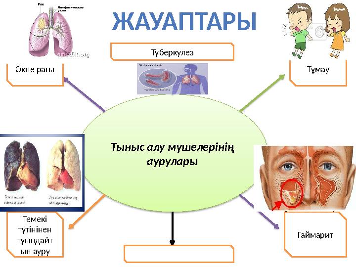 ЖАУАПТАРЫ Тыныс алу мүшелерінің аурулары Тұмау Туберкулез Өкпе рагы Темекі түтінінен туындайт ын ауру Гаймарит