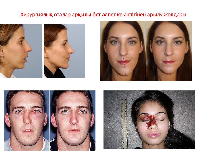 Хирургиялық оталар арқылы бет әлпет кемістігінен арылу жолдары