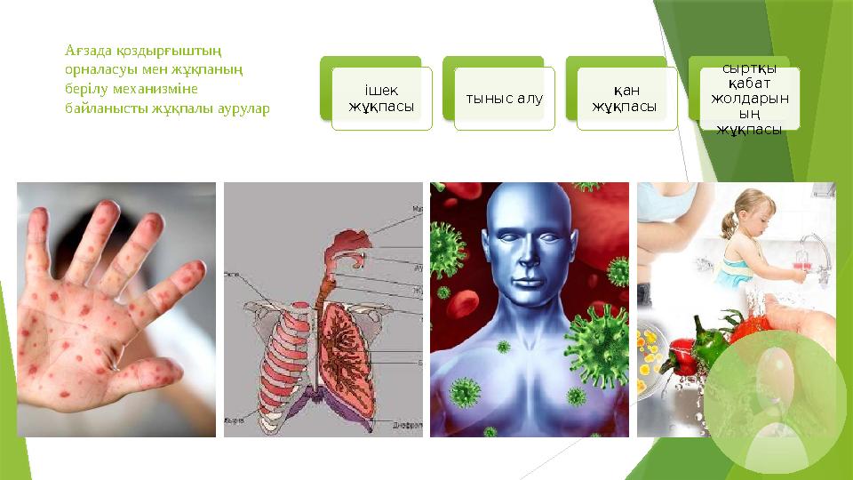 Ағзада қоздырғыштың орналасуы мен жұқпаның берілу механизміне байланысты жұқпалы аурулар ішек жұқпасы тыныс алу қан жұқпасы